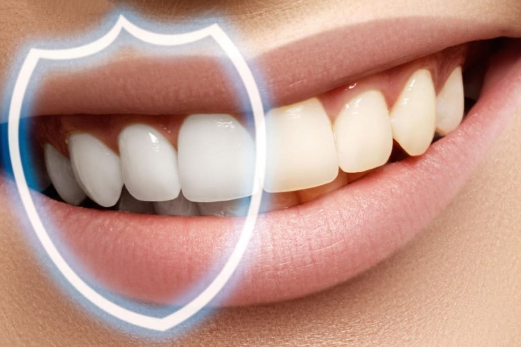 Восстановление эмали зуба