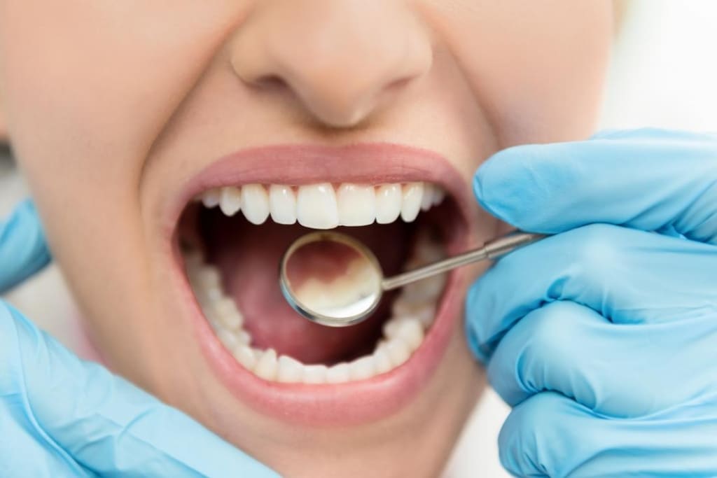 Инвагинация зубов или что такое «зуб в зубе»